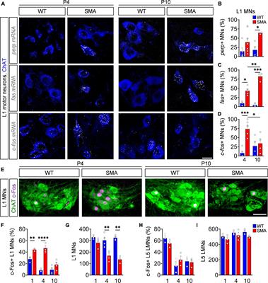 p53-dependent c-Fos expression is a marker but not executor for motor neuron death in spinal muscular atrophy mouse models